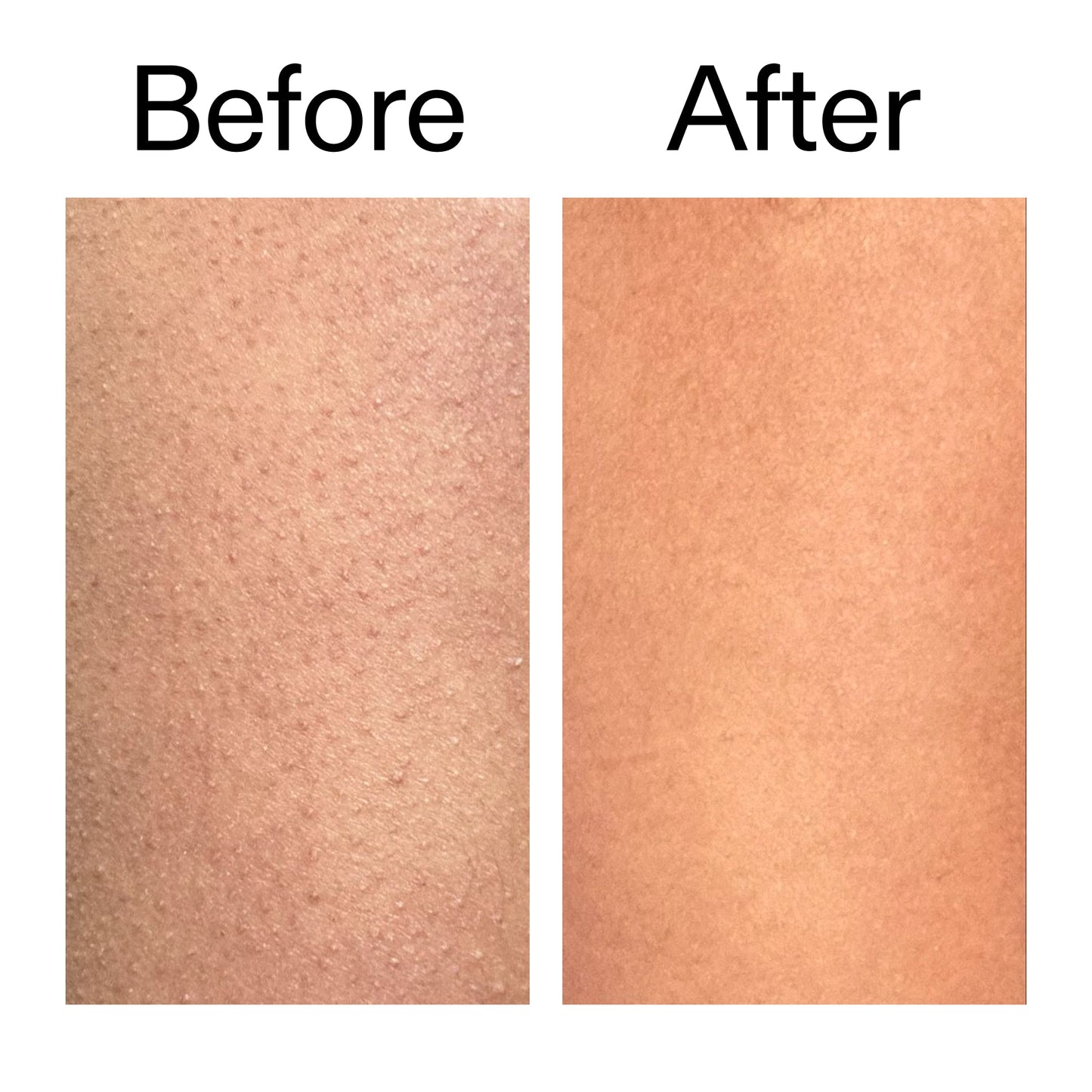 glycolic-acid-exfoliating-body-stick-o5 Glycolic_Body_Stick_B_A_2000x2000_6e6e6b4d-5bd7-43c0-aeed-4d66788e8995.jpg