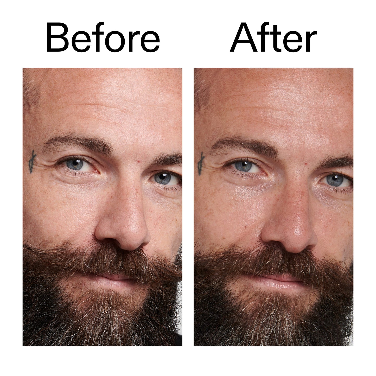 peptide-moisturizer-i7 Peptide_Moisturizer_Before_After_2000x2000_84623fe4-7b72-4f89-8e87-5edb6c752ac5.jpg
