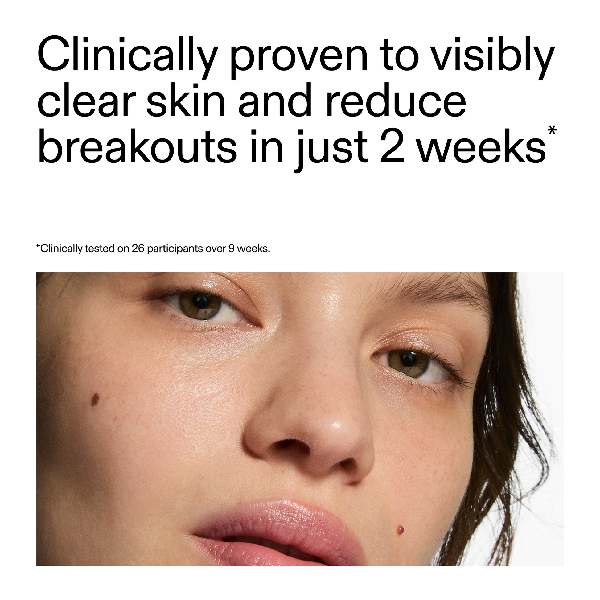 360-acne-clearing-duo-s2 360_Serum_Key_Claim.png