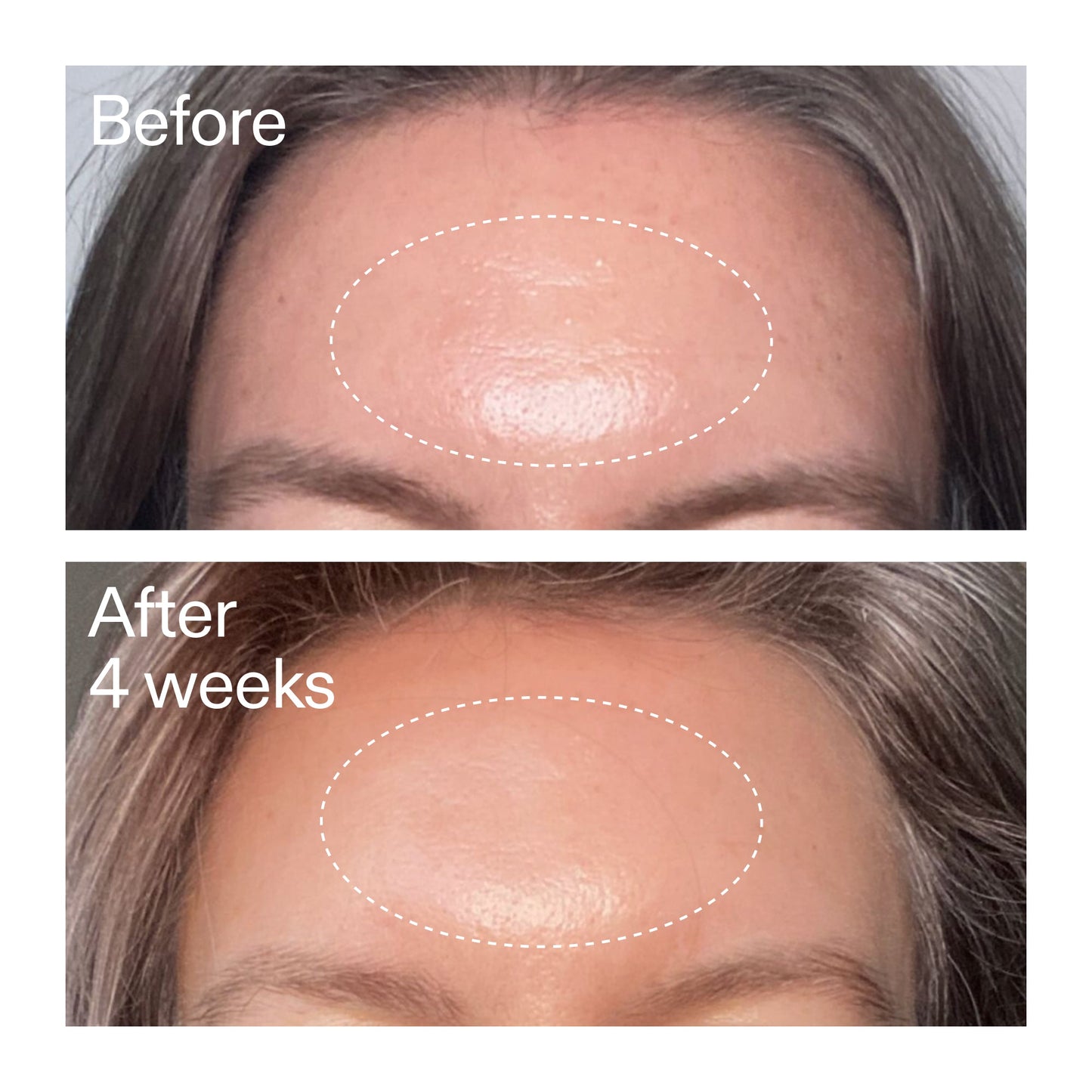 advanced-0-2-retinal-serum-duo-i2 AdvancedRetinal_BeforeAfter1_2000x2000_4e9c798a-f30e-45b8-a34a-7c4740f2f2cb.jpg