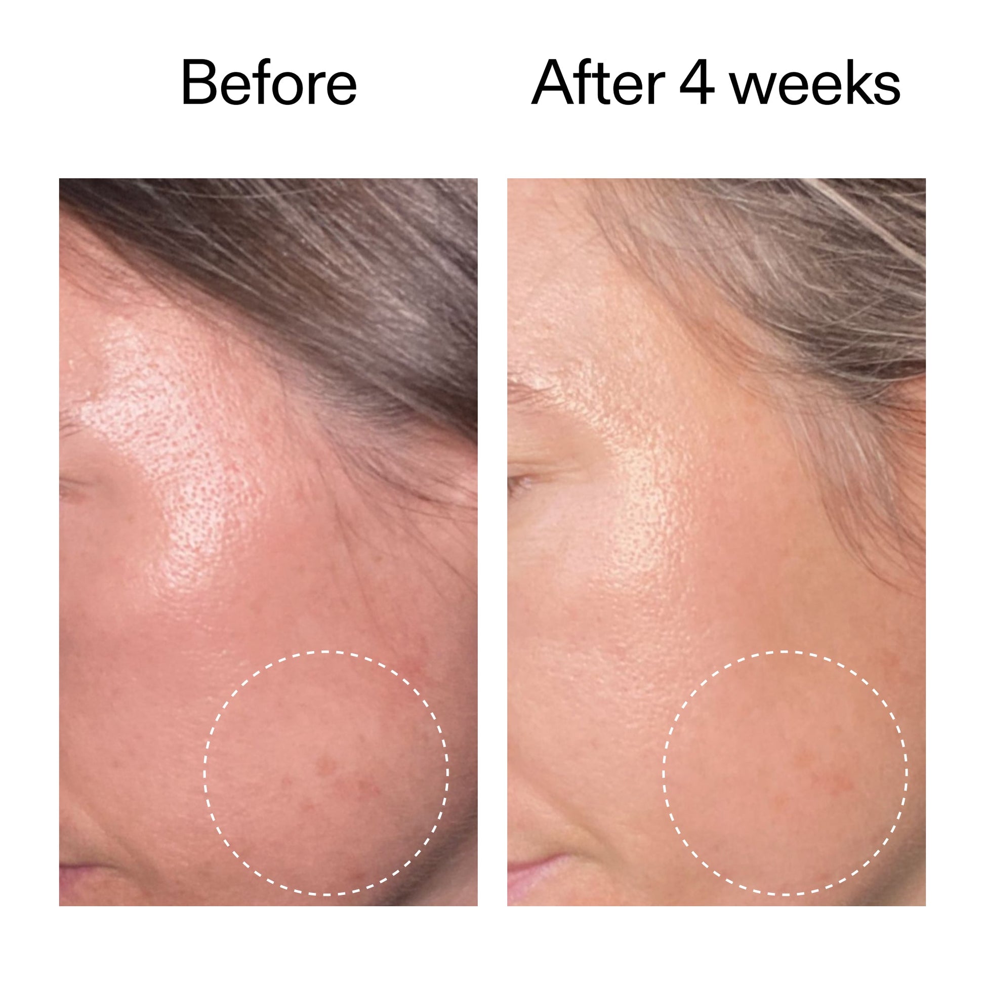 advanced-0-2-retinal-serum-duo-i2 AdvancedRetinal_BeforeAfter2__2000x2000_8ef75542-2316-4814-81ee-0f66a85912bc.jpg