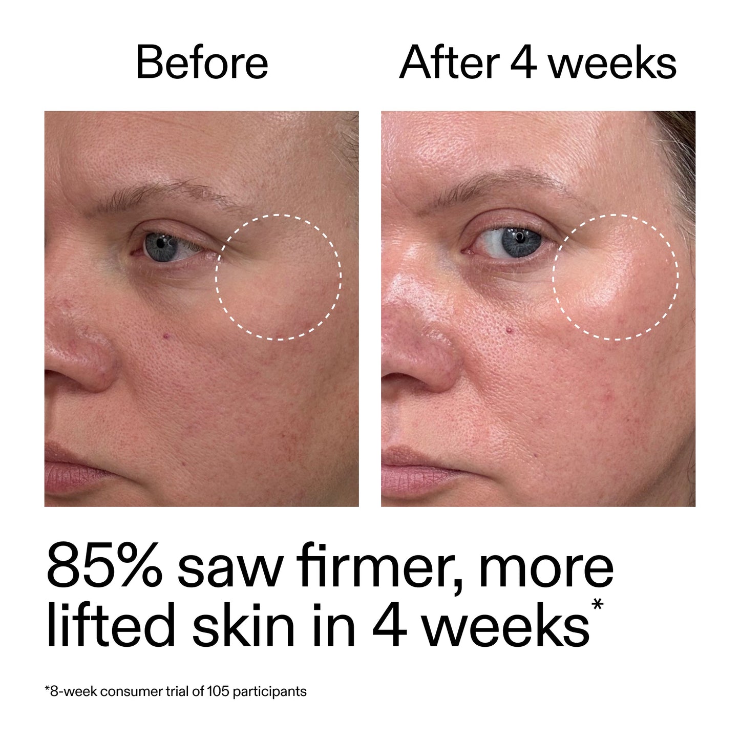 advanced-0-2-retinal-serum-n4 AdvancedRetinal_BeforeAfter_Claim1_2000x2000_bcc385c4-5e73-4f1e-aba8-64267937d0d3.jpg