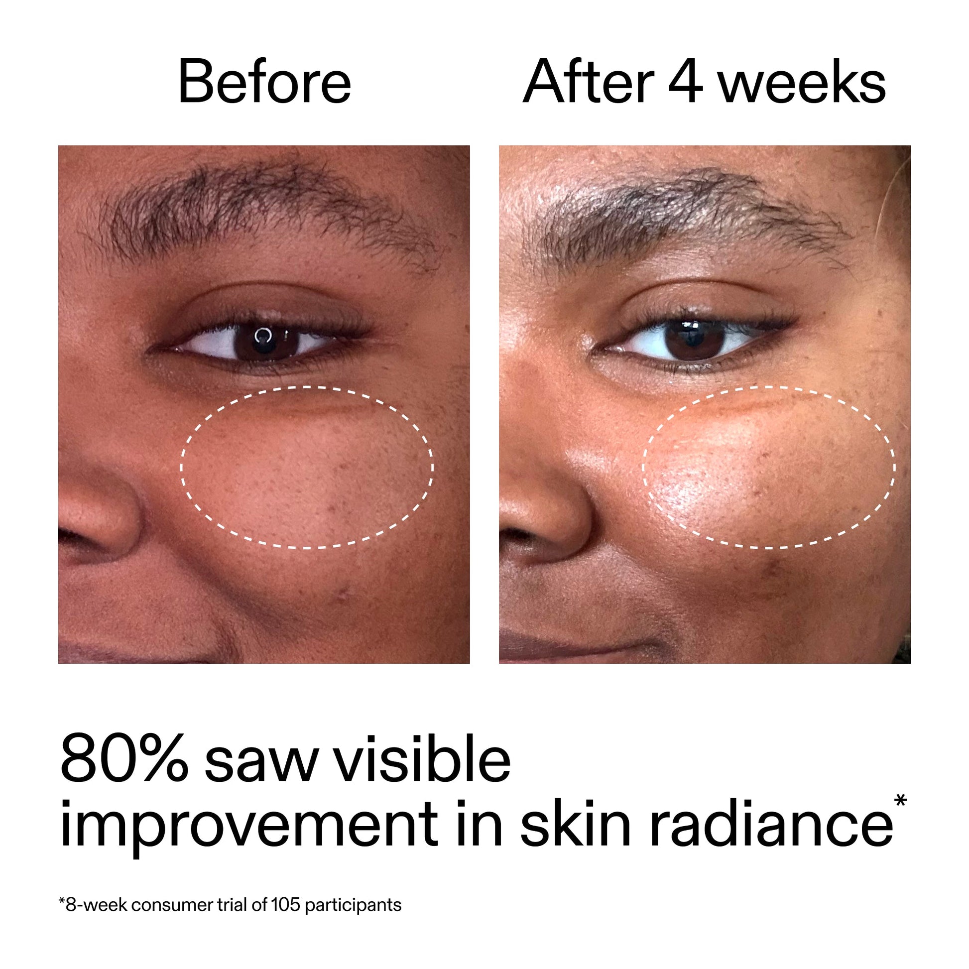 advanced-0-2-retinal-serum-n4 AdvancedRetinal_BeforeAfter_Claim2_2000x2000_39d11e3d-eda9-44ec-ab32-2903b1a368bd.jpg
