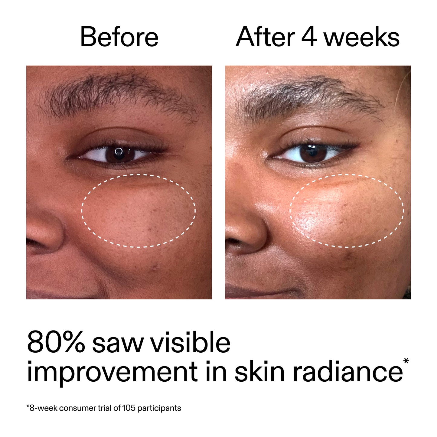 advanced-0-2-retinal-serum-duo-i2 AdvancedRetinal_BeforeAfter_Claim2_2000x2000_681b621d-8d44-4d44-9a40-89244f9b2e53.jpg
