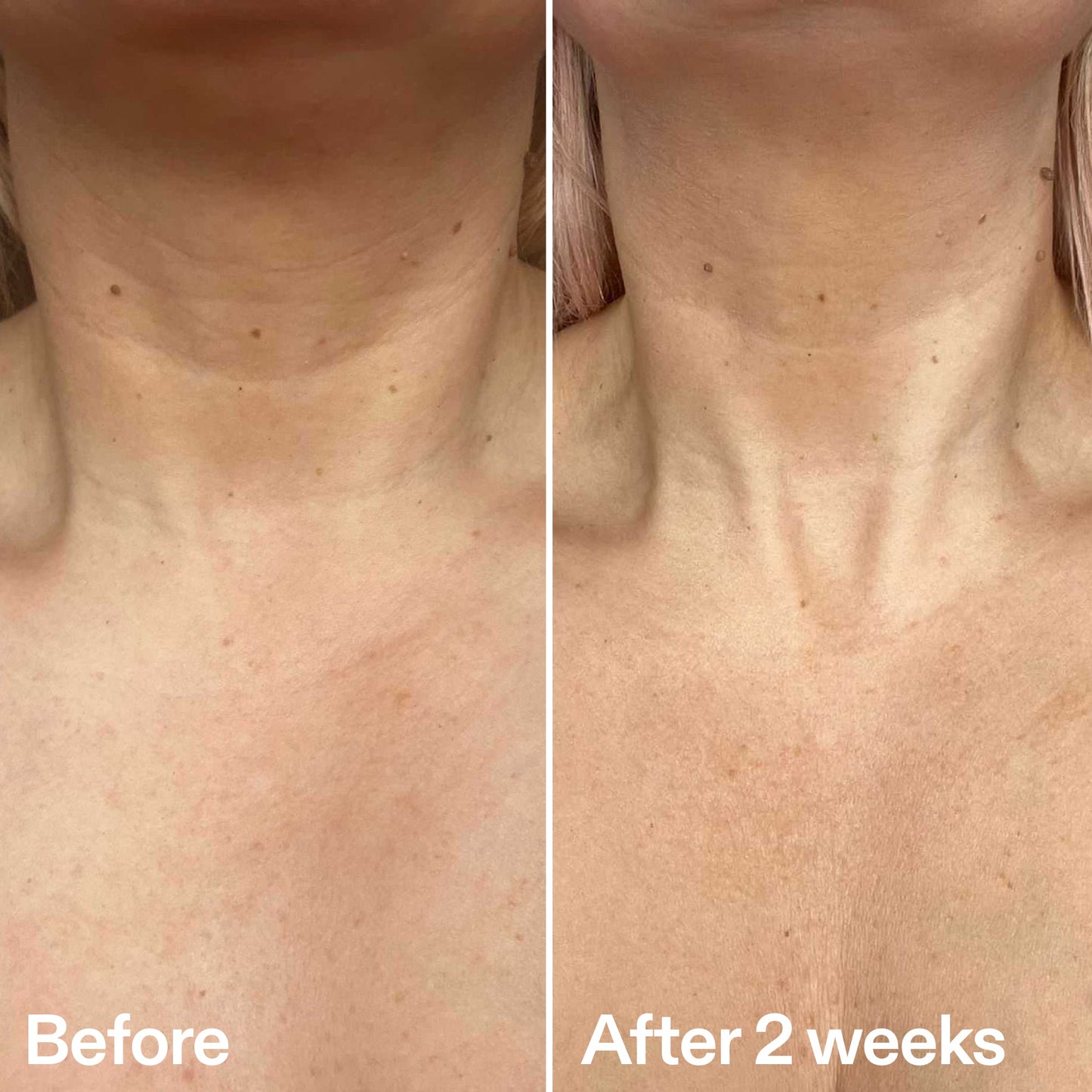 bio-active-neck-lift-stick-p8 B_A_2.jpg