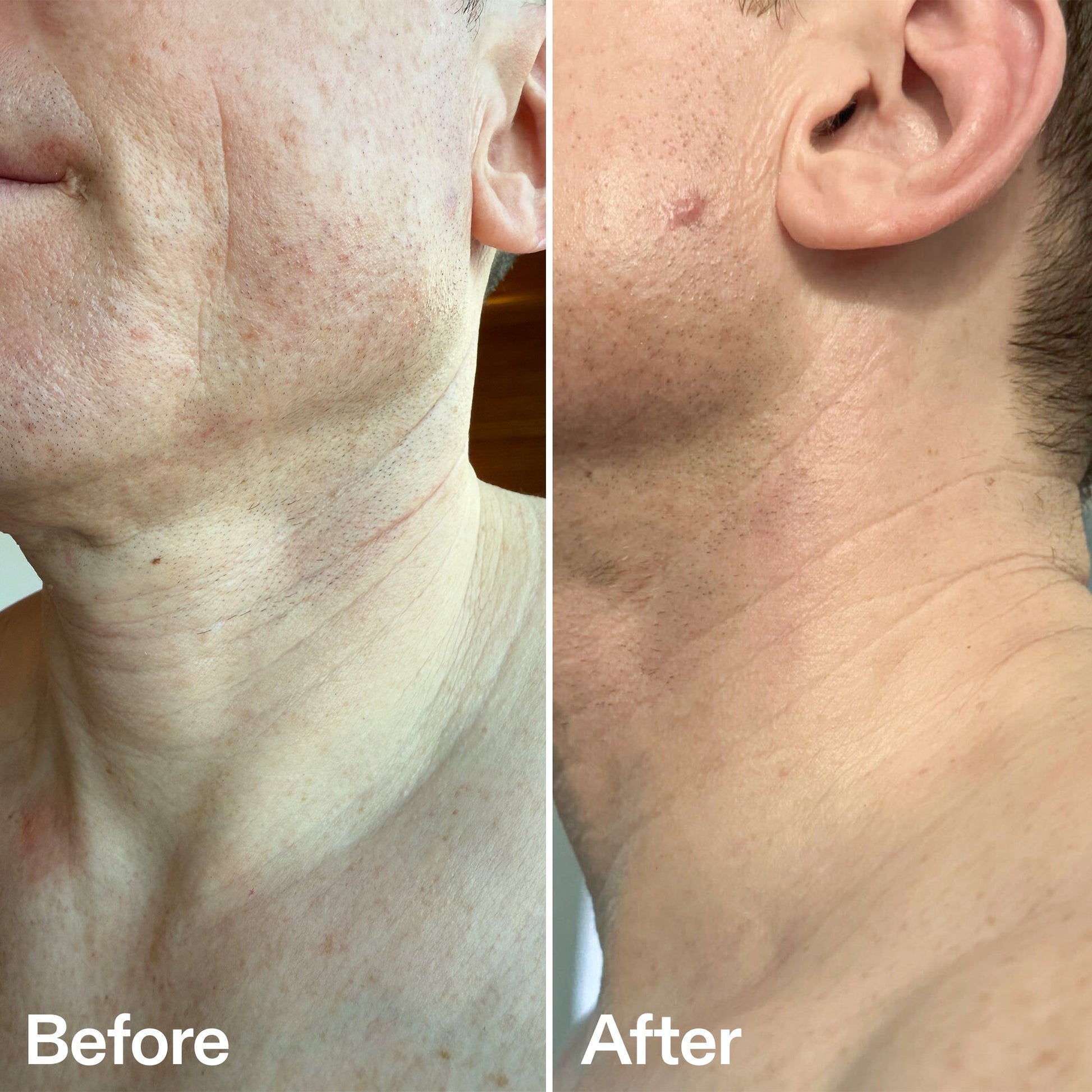 bio-active-neck-lift-stick-p8 B_A_afa2743e-b8e2-4504-92f4-e281cb6cf759.jpg