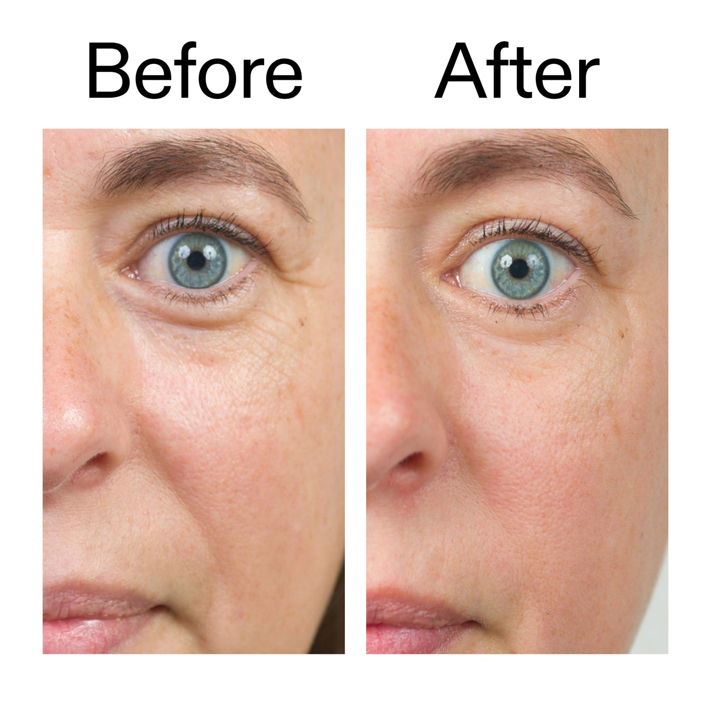 bio-active-ceramide-moisturizer-g6 Bio-Active_Before_After_2000x2000_566e5a9e-135e-417a-8242-b44e5fa35463.jpg
