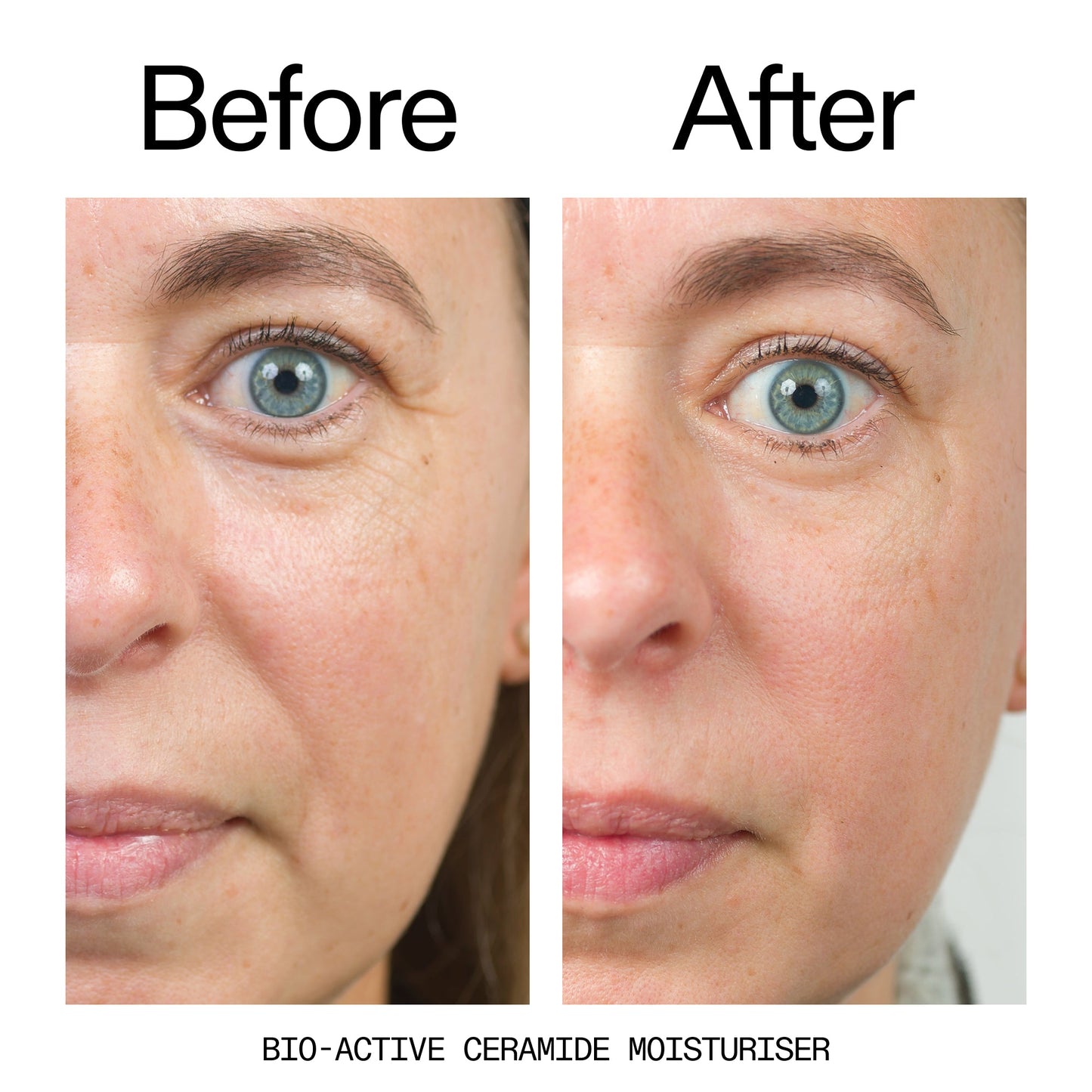 barrier-boosting-trio-j9 Bio-Active_Before_After_2000x2000_600947b4-e8c5-425a-9155-fc15bc83aa12.jpg