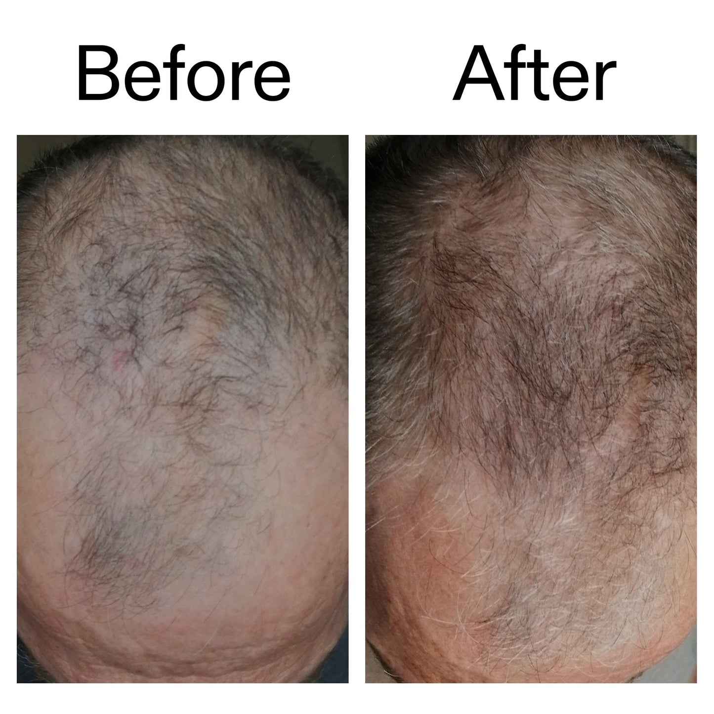 3-month-hair-growth-trio-x6 Caffeine_Scalp_Treatment_B_A_Ppage_2000_x_2000.jpg