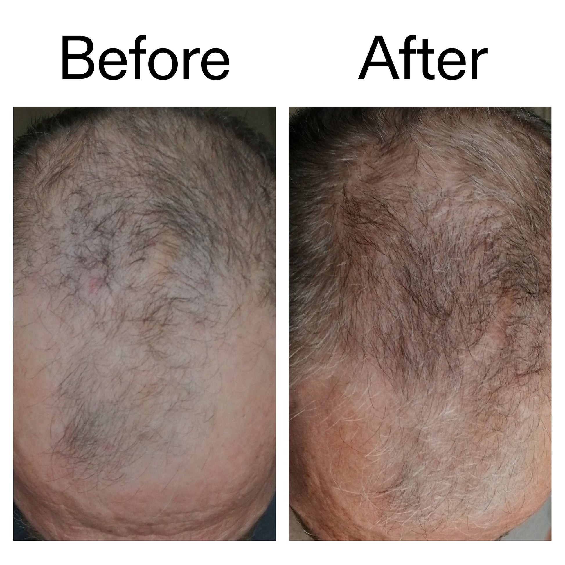 3-month-hair-growth-trio-x6 Caffeine_Scalp_Treatment_B_A_Ppage_2000_x_2000.jpg