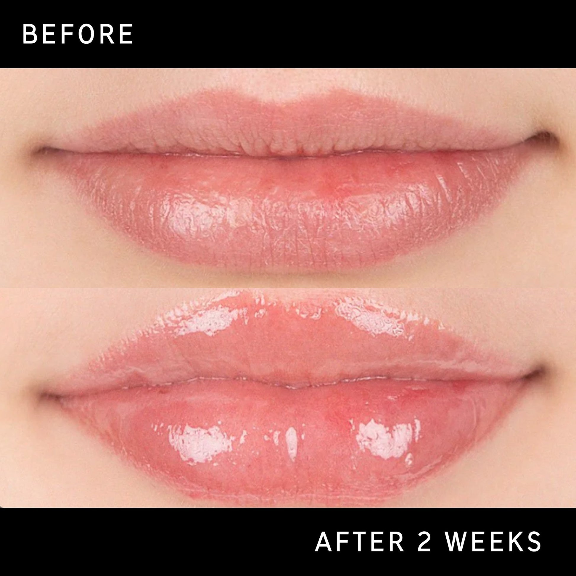 lip-plumping-duo-w8 DTC-Top15_Amends_Tripeptide-Lip_B_A.jpg