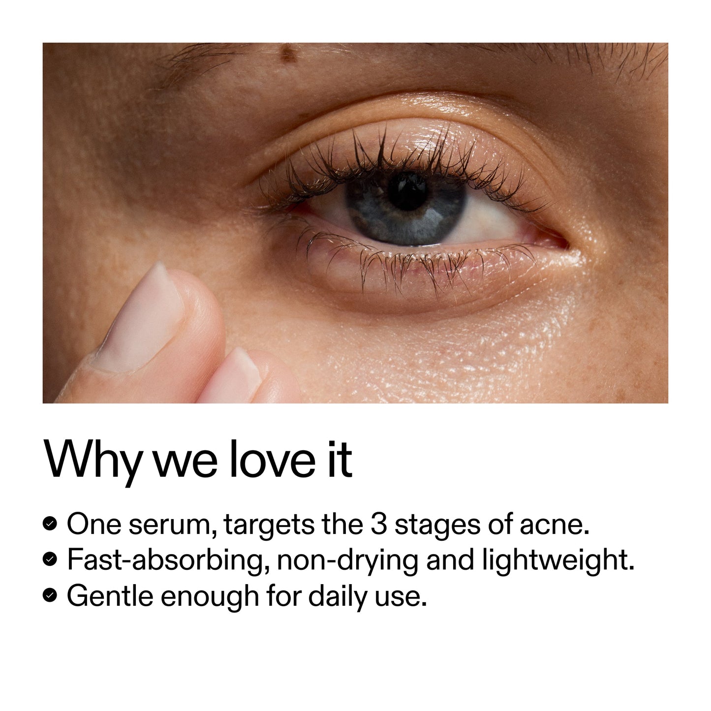 360-acne-clearing-serum-g5 Dioic_Whyweloveit_2000x2000_175aafd3-0cbe-403a-b317-a8362881bfe2.jpg