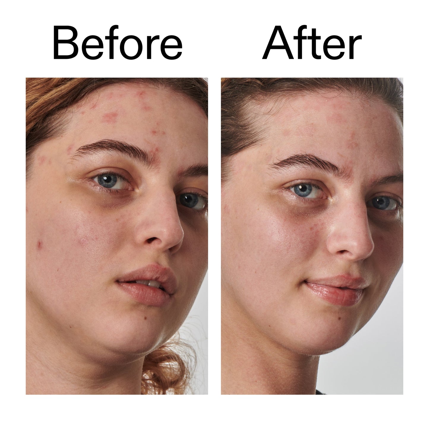 10-urea-moisturizer-v3 Dry_and_Rough_Skin_Solution_Before_After_2000x2000_efa6e639-5c39-49bd-a5dd-f0220293120a.jpg