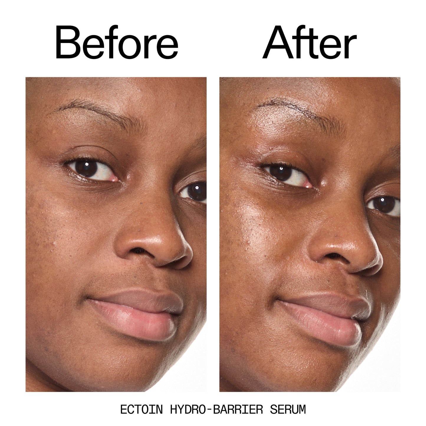 barrier-boosting-trio-j9 Ectoin_Before_After_2000x2000_ce35bc41-4da0-4b6f-adc7-29f8641f6c6c.jpg