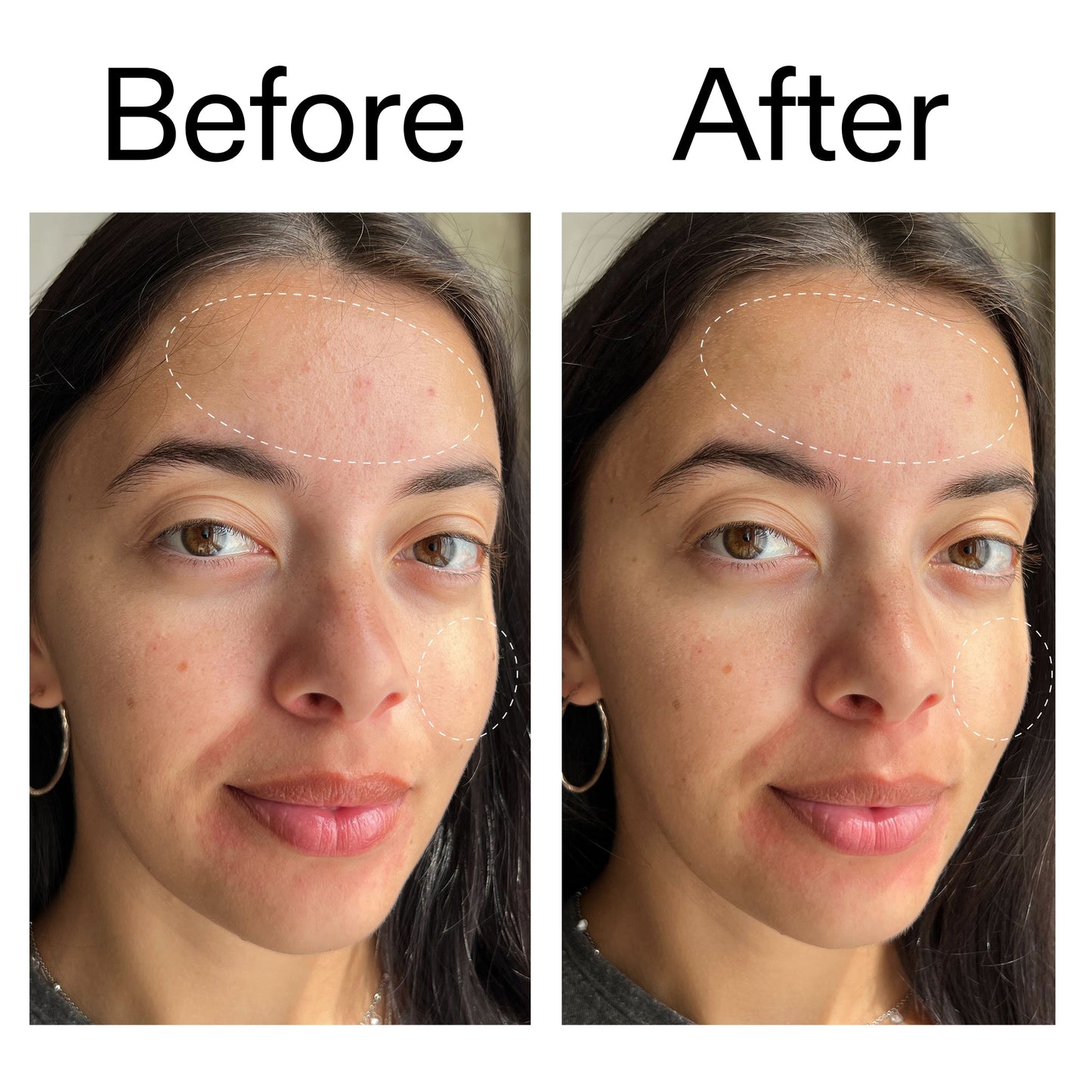 glycerin-gentle-purifying-cleanser-q1 Glycerin_B_A_2000x2000_19037705-c220-4333-99c1-e648cc3ac1d7.jpg