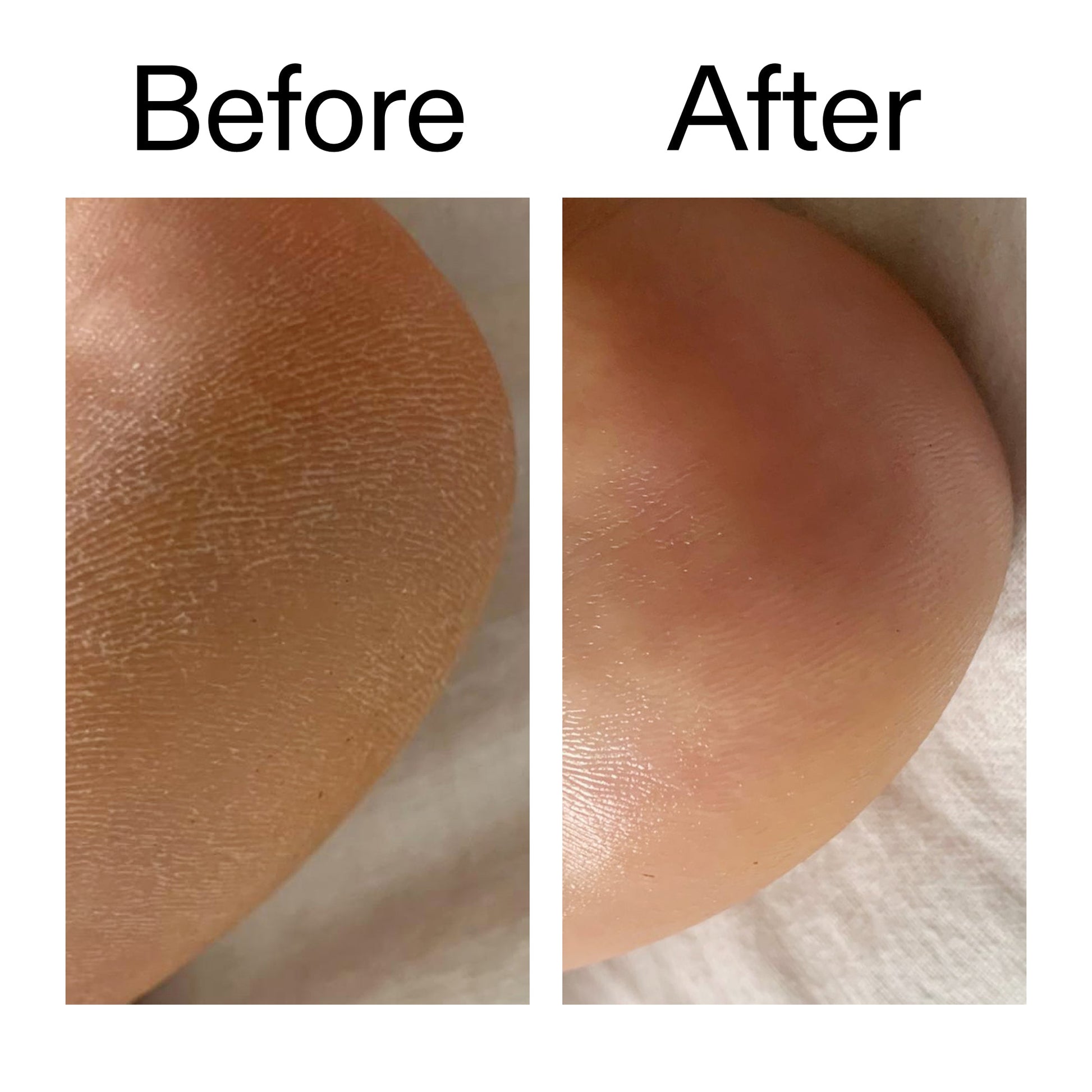 glycolic-acid-exfoliating-body-stick-o5 Glycolic_Acid_Exfoliating_Body_Stick_Before_After_V1_2000x2000_a3043625-9400-429a-a7fb-d6dbd220f722.jpg