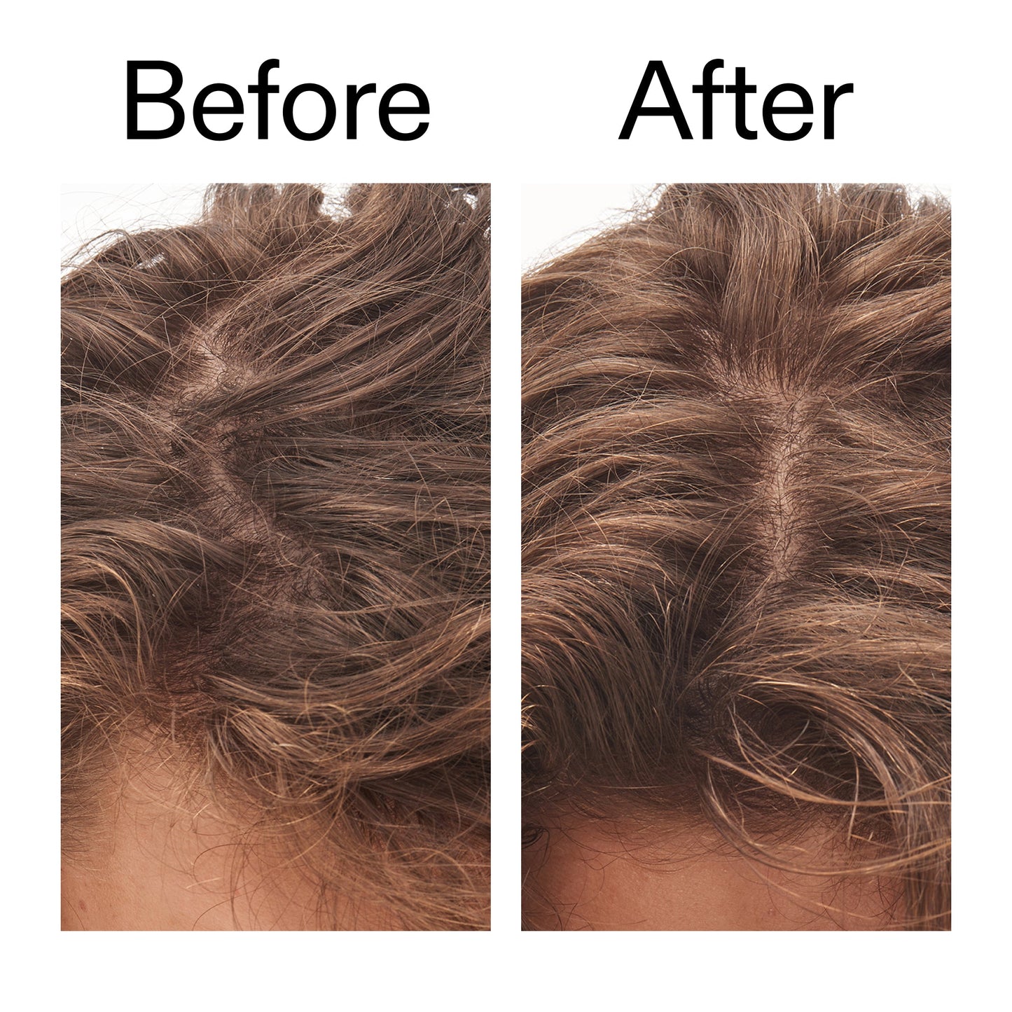 glycolic-acid-exfoliating-scalp-scrub-w0 Glycolic_Acid_Exfoliating_Scalp_Scrub_Before_After_2000x2000_b8561c87-05a1-4caa-80f7-1b6b33d750f7.jpg