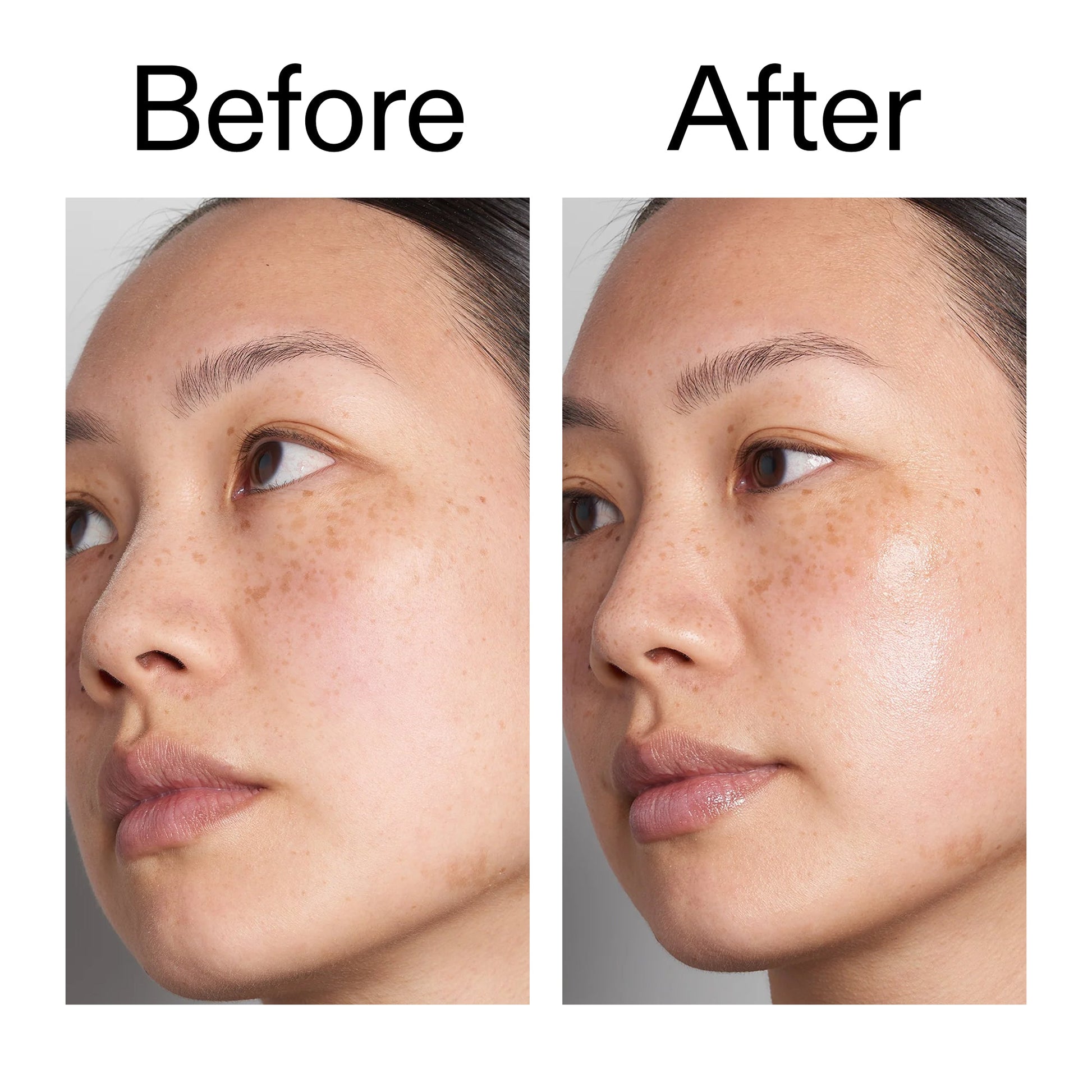supersize-hyaluronic-acid-serum-100ml-e6 Hyaluronic_Acid_Before_After_2000x2000_d7983956-8aa2-4ea3-8255-c63e8d4f892e.jpg