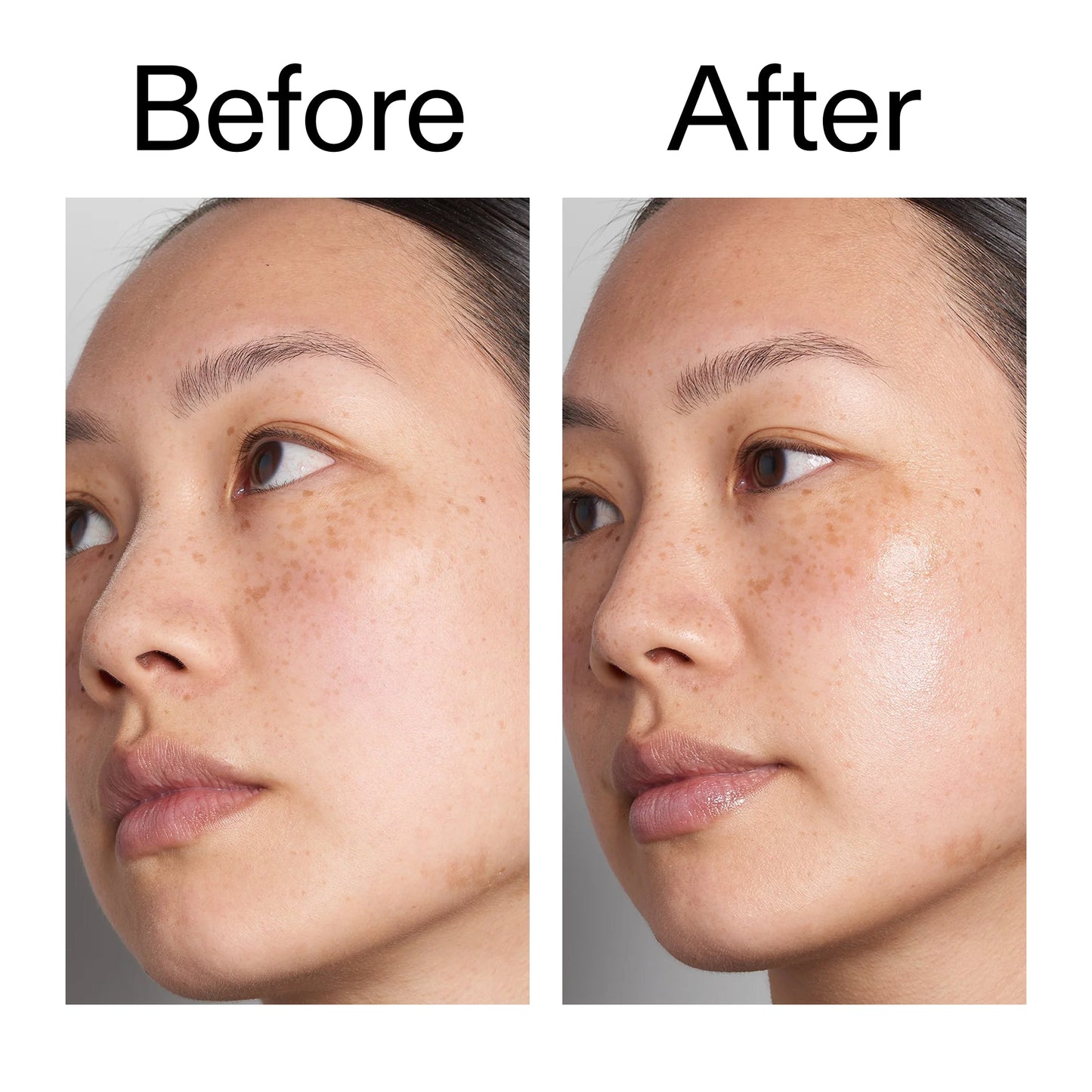supersize-hyaluronic-acid-serum-100ml-duo-t5 Hyaluronic_Acid_Before_After_2000x2000_d7983956-8aa2-4ea3-8255-c63e8d4f892e.jpg