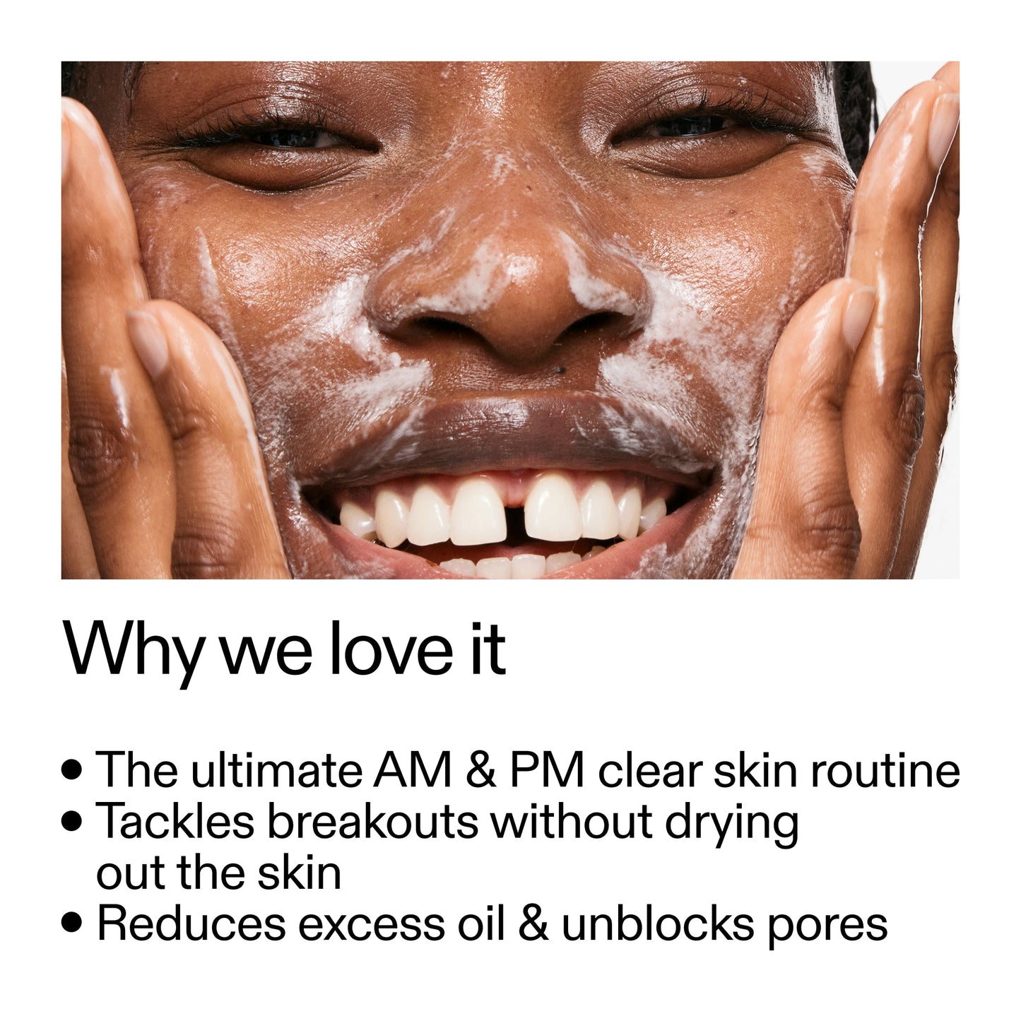 intro-routine-for-acne-l8 Intro_Routine_for_Acne_Why_we_love_it_2000x2000_42499e10-4629-4a0e-a627-7e215f4da6bc.jpg