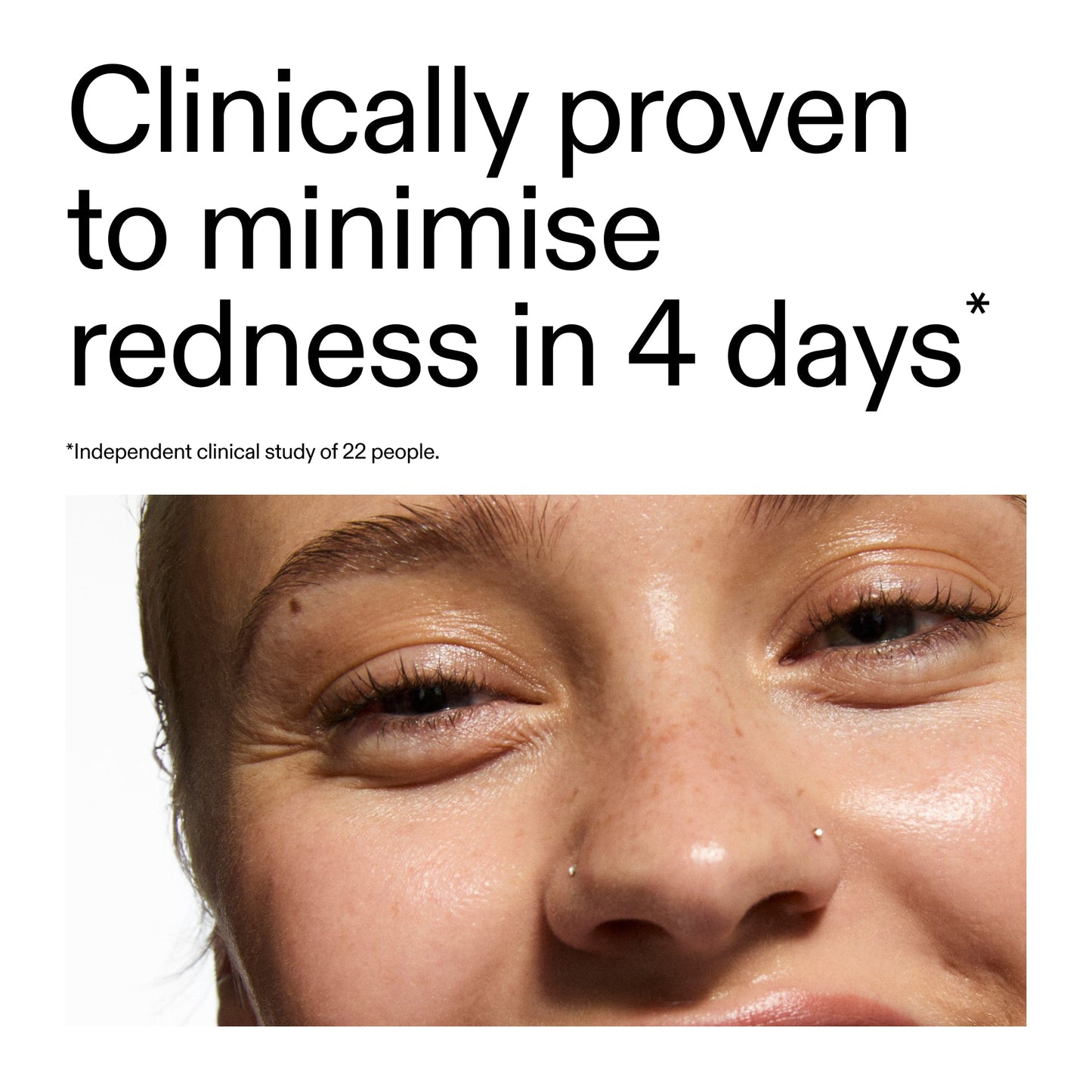 10-azelaic-acid-serum-for-redness-relief-g1 Oat_Cleansing_Balm_Claim_2000x2000_52a841dc-353c-4f2c-8646-3aadb604507d.jpg