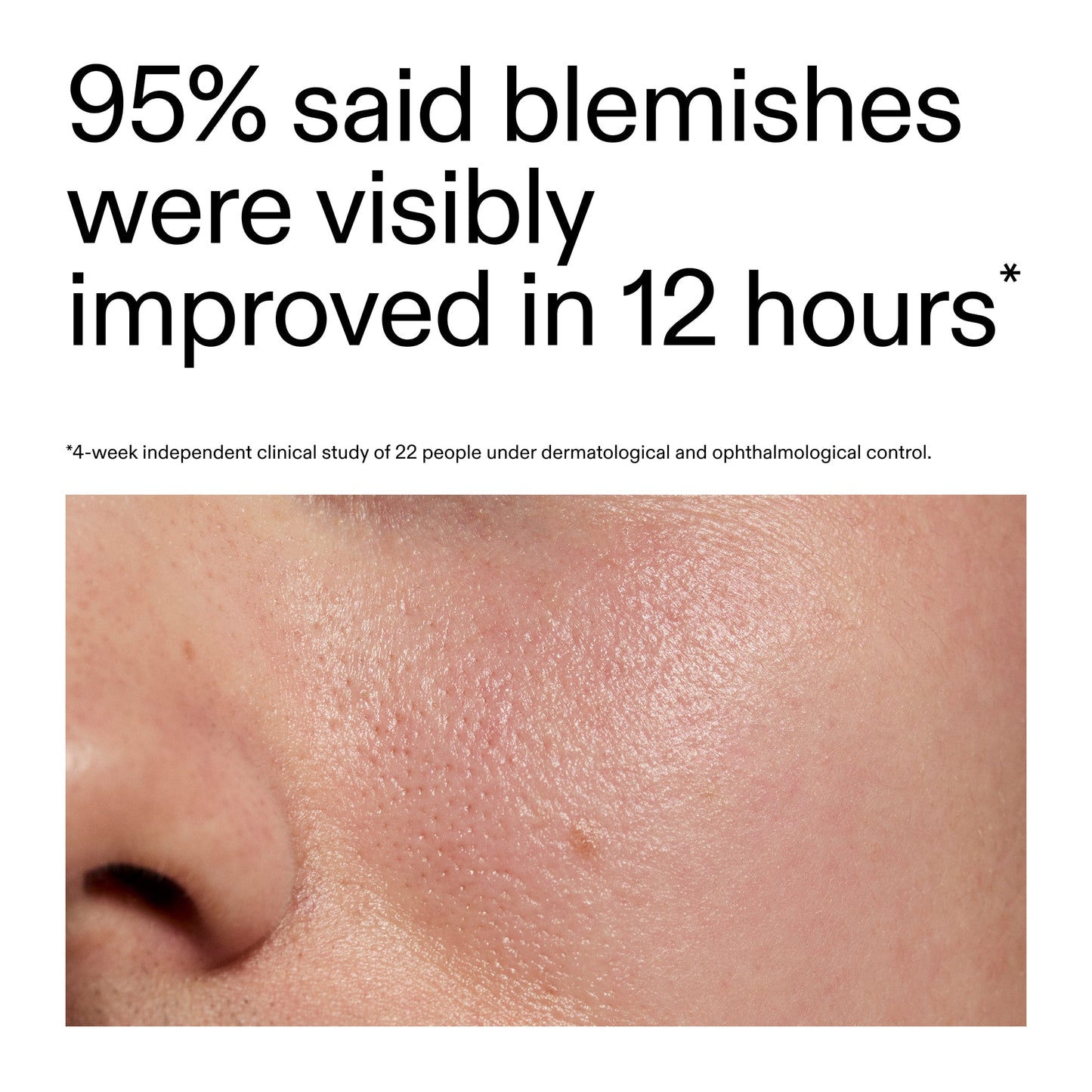 succinic-acid-acne-treatment-e1 Oat_Cleansing_Balm_Claim_2000x2000_ac6ce553-25db-41b2-a981-faae1ac4b8c0.jpg