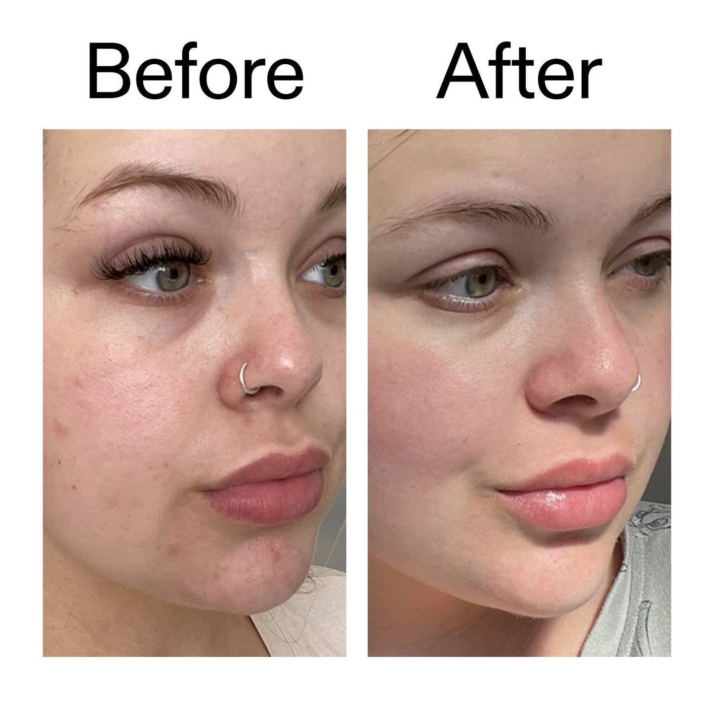 omega-water-cream-50ml-b7 Omega50_Before_After_2000x2000_46483ed8-3f9d-487f-9a0c-9df79830bd65.jpg