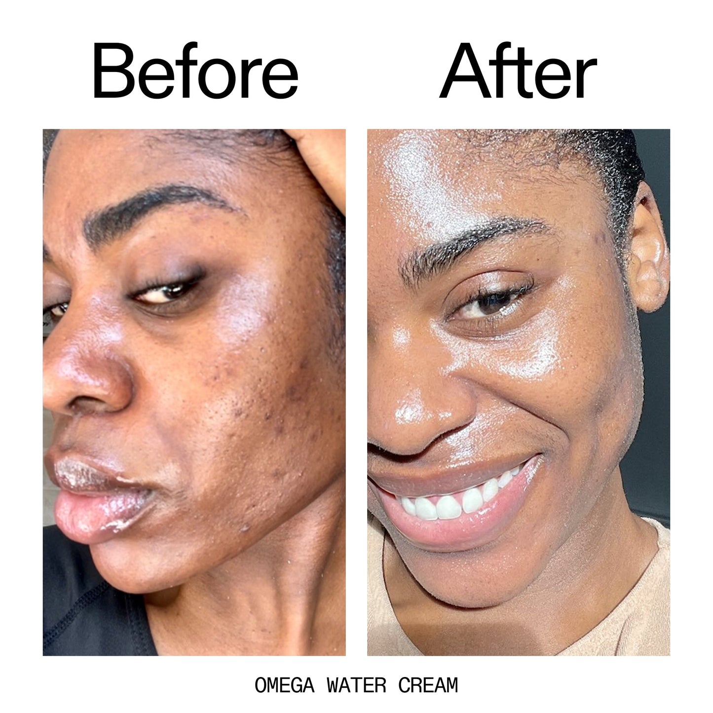 glowing-skin-set-r3 Omega_Water_Cream_Before_After_2000x2000_8e88278b-8c8d-48dc-ac77-4e98ebbd1b77.jpg