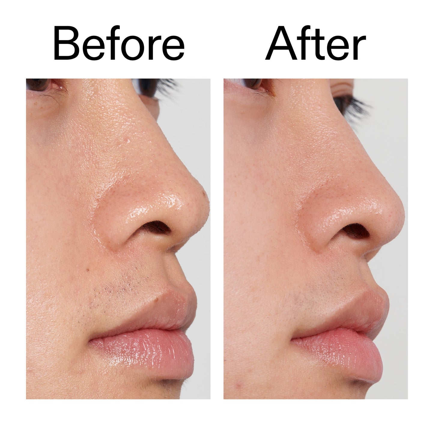 pha-toner-y7 PHA_Toner_Before_After_2000x2000_e3c10172-0150-4342-8b95-57417eaff50d.jpg