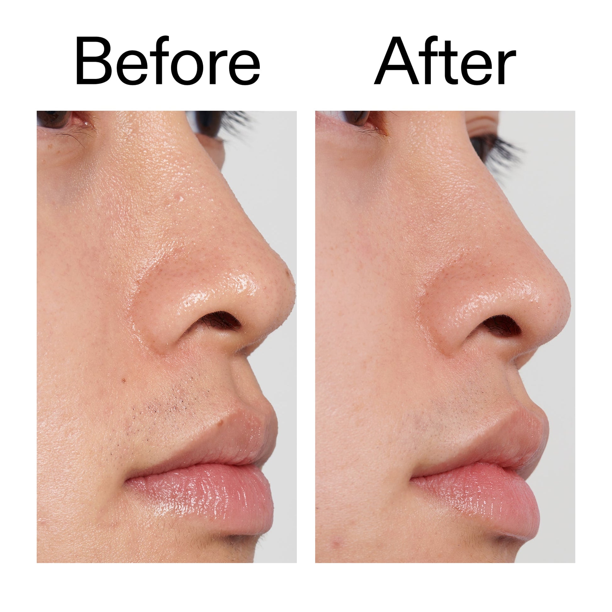 pha-toner-y7 PHA_Toner_Before_After_2000x2000_e3c10172-0150-4342-8b95-57417eaff50d.jpg