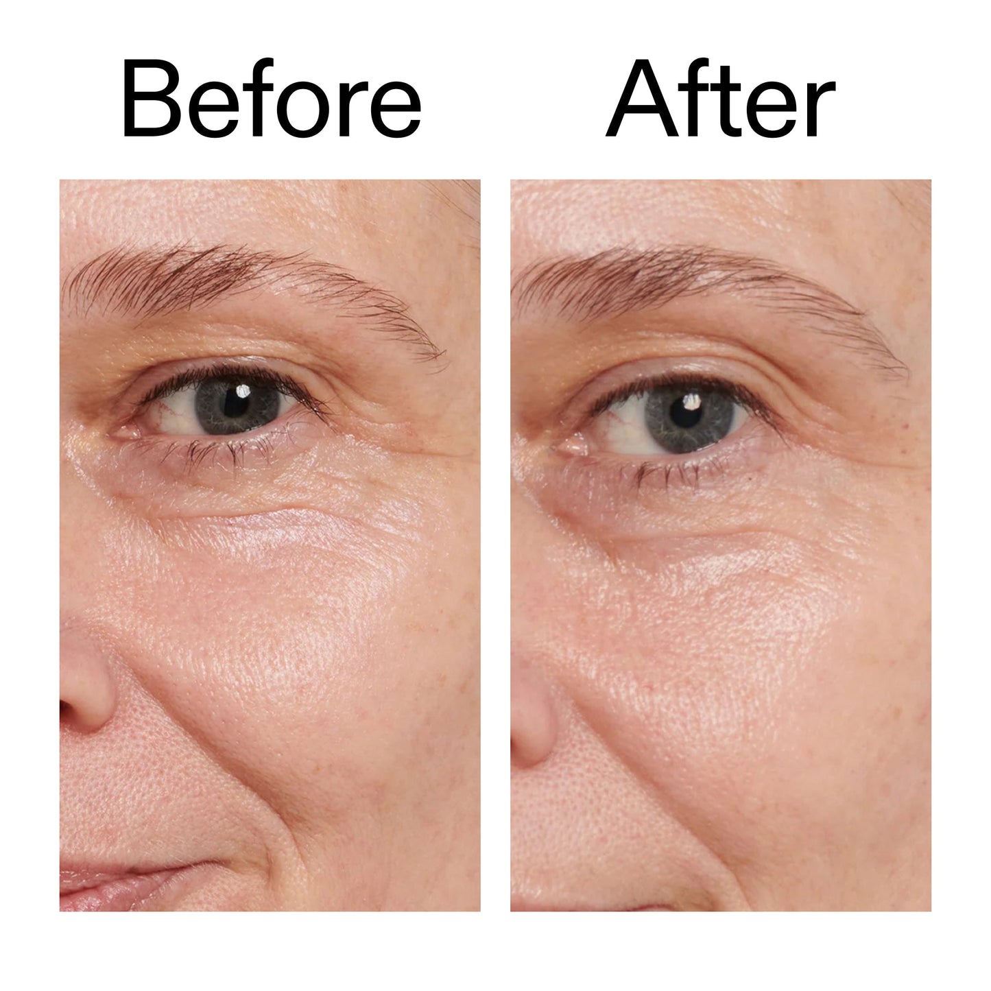 retinol-eye-cream-r8 Retinol_Eye_Cream_Before_After_2000x2000_ac03a80c-109e-4572-a95a-91dc109b4d27.jpg