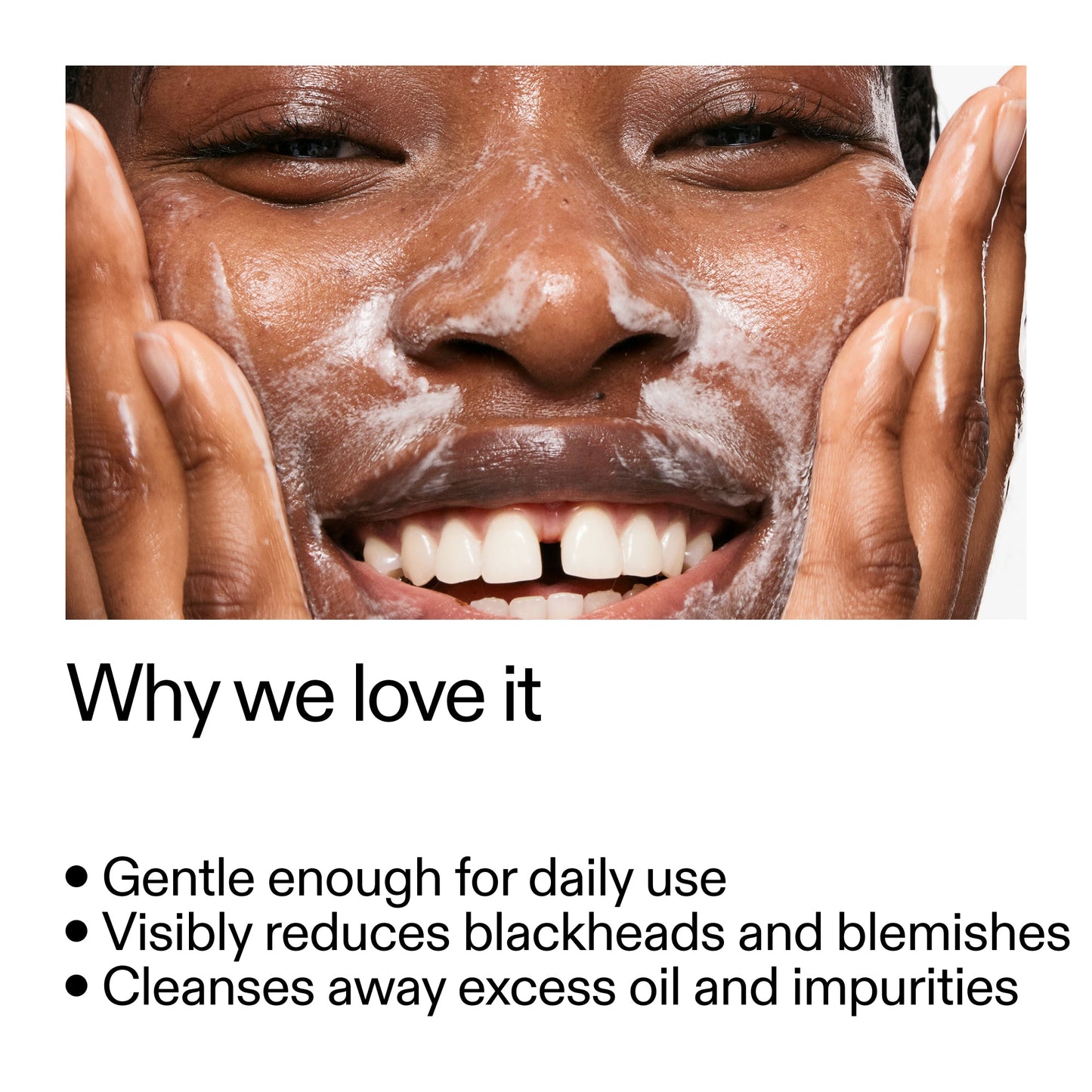 salicylic-acid-cleanser-duo-b0 Salicylic_Acid_Cleanser_-_300mlWhy_we_love_it_2000x2000_87dc92a9-2559-4309-98cd-4e570f1be735.jpg