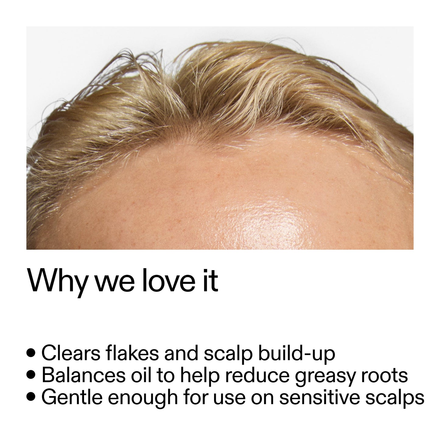 salicylic-acid-exfoliating-scalp-treatment-b2 Salicylic_Acid_Exfoliating_Scalp_Treatment_Why_we_love_it_2000x2000_44b6bd6d-9ec4-4b23-9dc4-bc3fd6f28e14.jpg