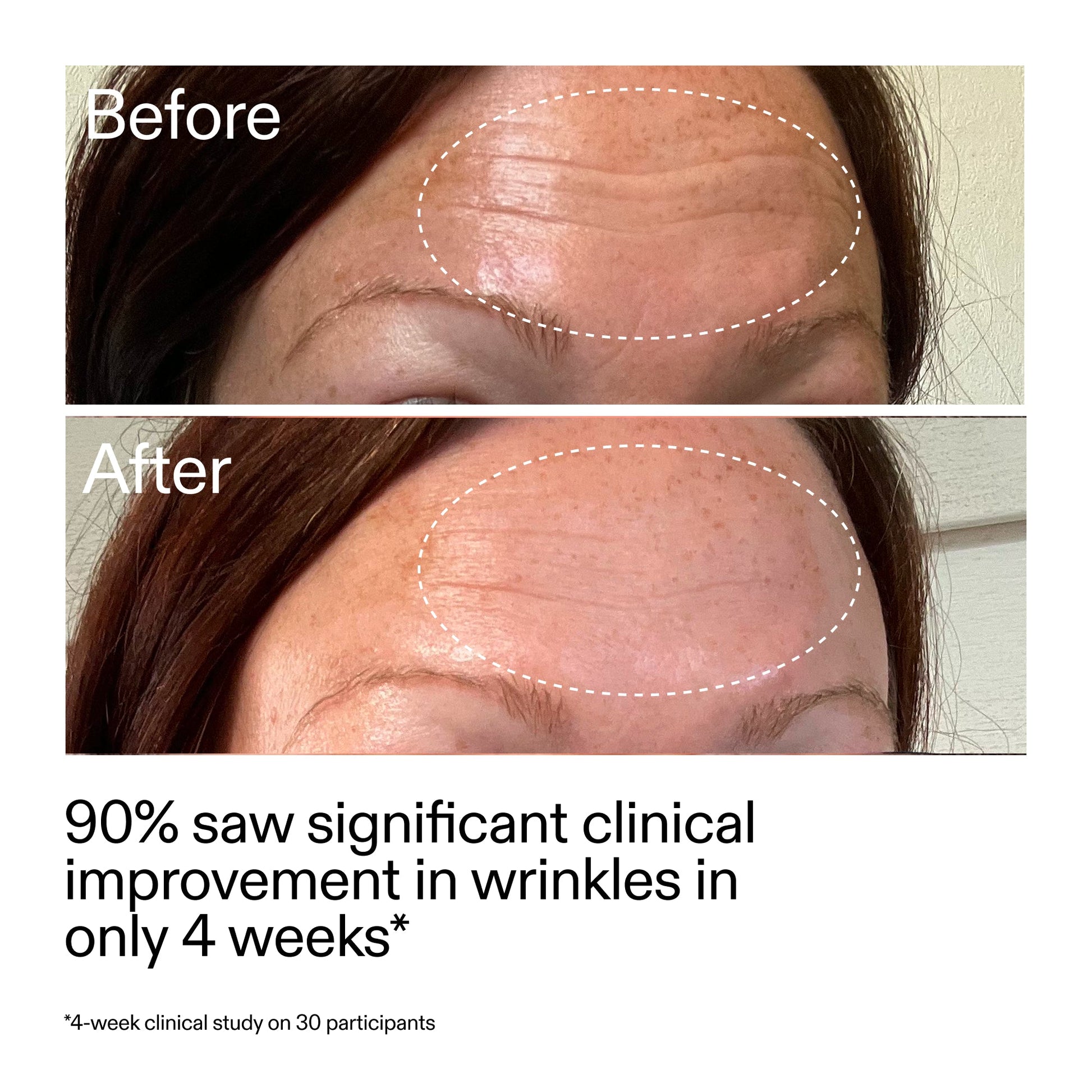 starter-retinol-serum-duo-c1 StarterRetinol_BeforeAfter_Claim1_2000x2000_03b4d6e5-a357-43b9-a855-aba5e35c57f3.jpg