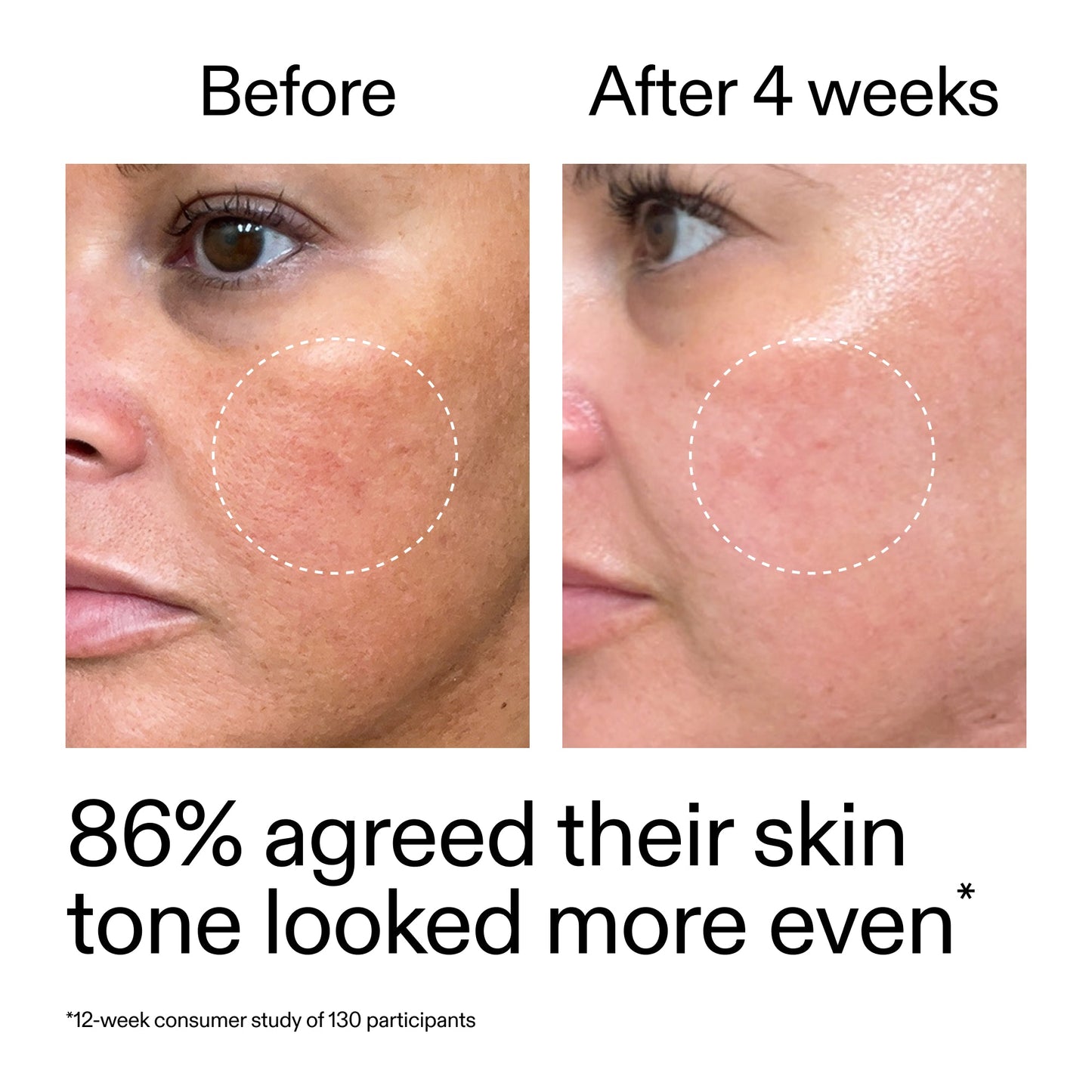 starter-retinol-serum-e6 StarterRetinol_BeforeAfter_Claim2_2000x2000_f5c9ecc0-8d76-429d-bef5-c3a61bcf5c09.jpg