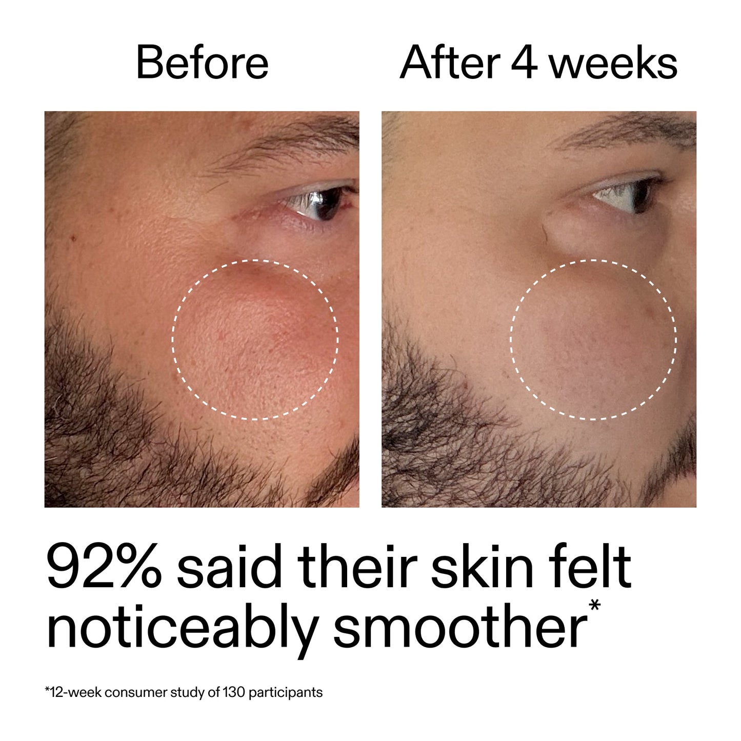 starter-retinol-serum-e6 StarterRetinol_BeforeAfter_Claim3_2000x2000_6ceab106-e0ee-4ed4-ba62-41bc39538038.jpg