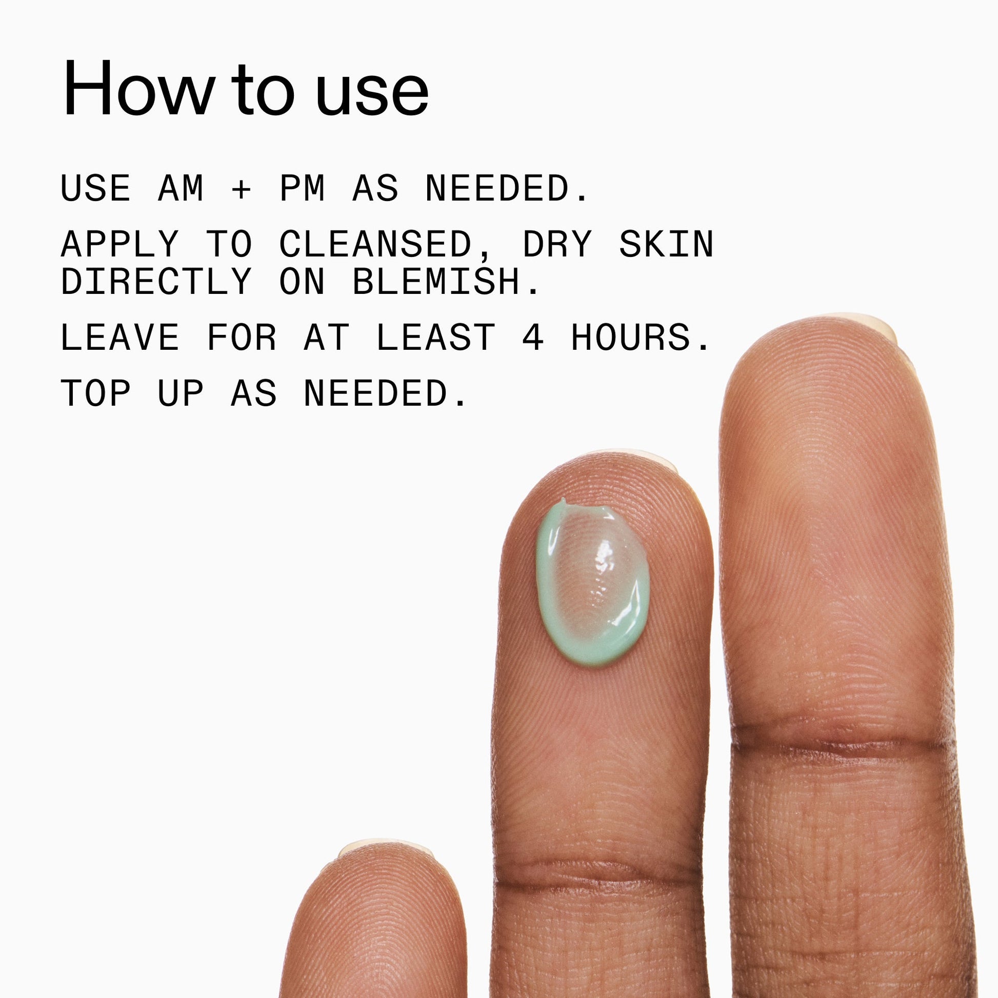 succinic-acid-acne-treatment-e1 Succinic_Acid_Treatment_How_to_Use_2000x2000_d57137d5-d7f1-427c-9a46-5fc00c19c542.jpg