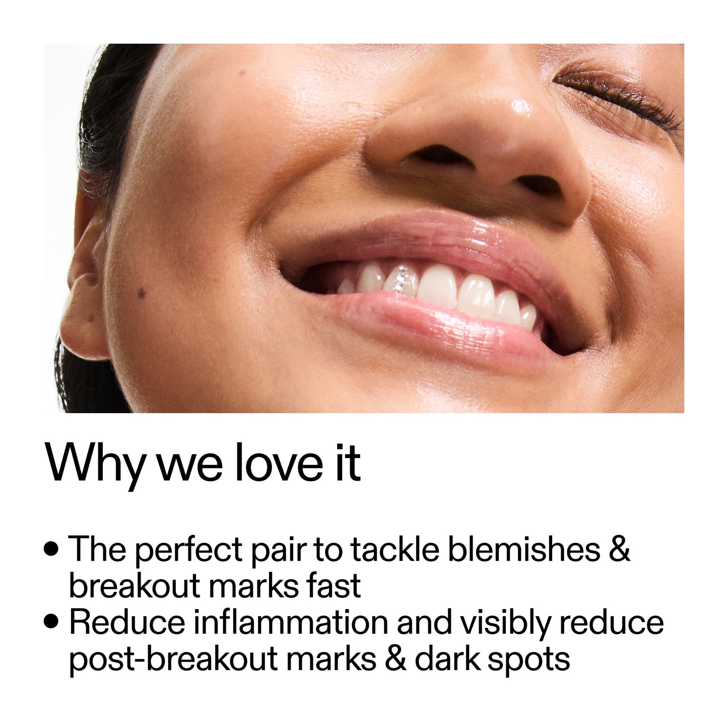 targeted-blemish-duo-o5 Targeted_Blemish_Duo_Why_we_love_it_2000x2000_ff00be46-438b-485f-b5c3-91e60bbb6919.jpg
