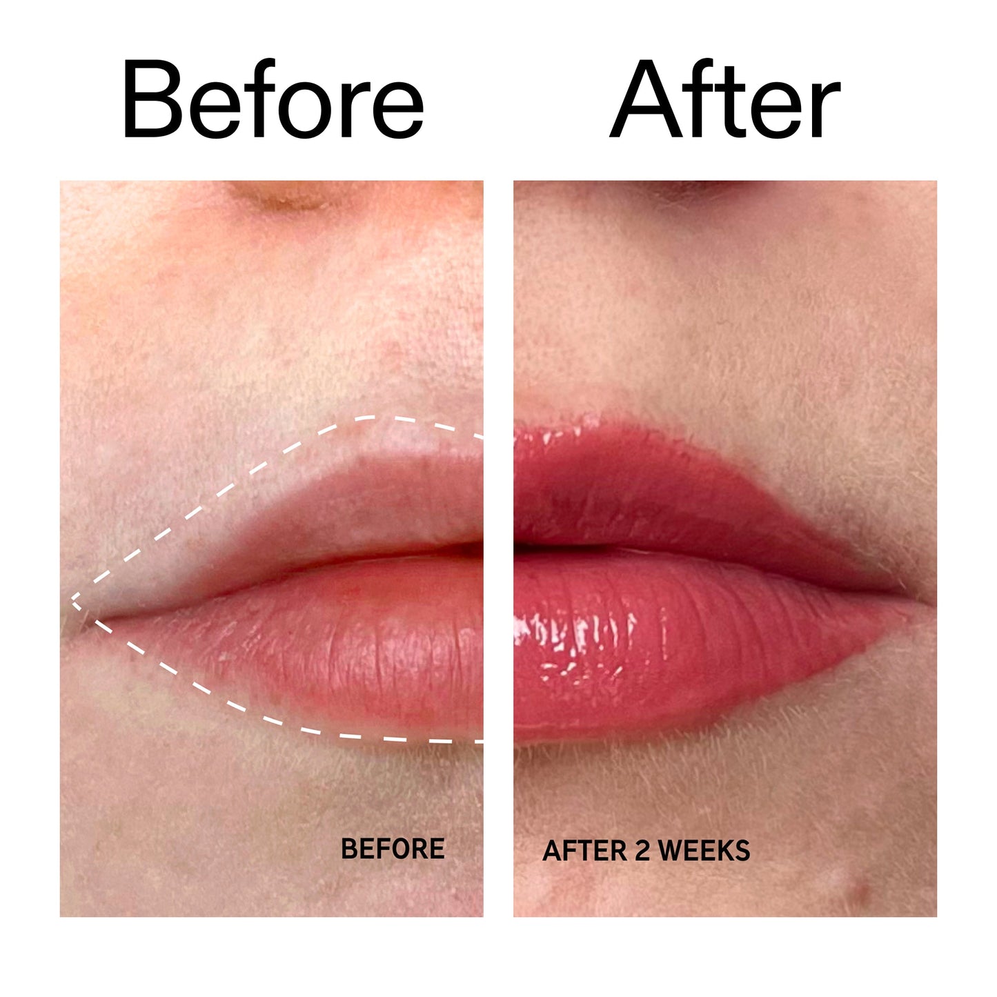 tripeptide-plumping-berry-lip-balm-n8 Tripeptide_Plumping_Lip_Balm_-_Berry_Before_After_2000x2000_9474bbd8-43ca-4b0e-b0e7-dfab70b91927.jpg