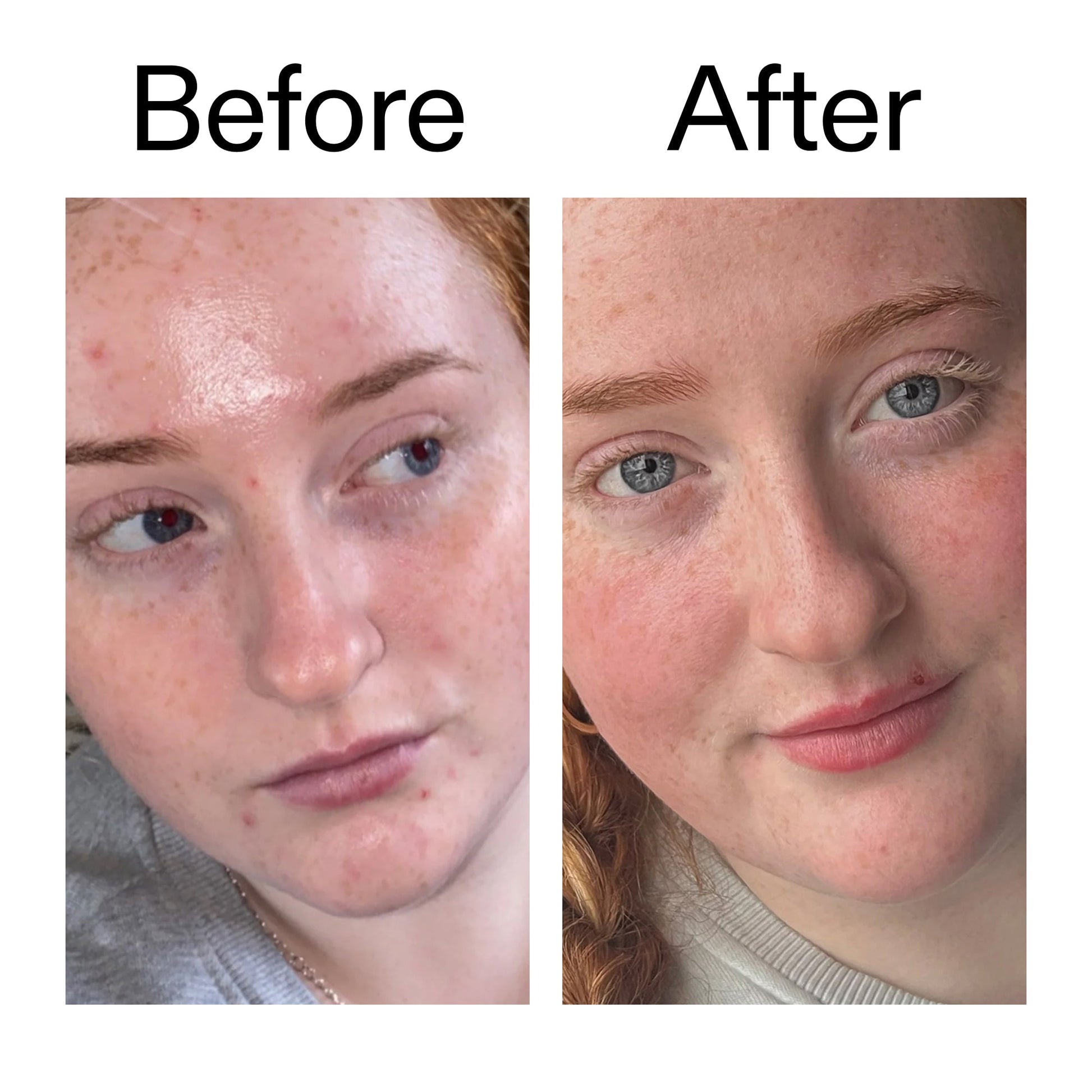 vitamin-b-c-and-e-moisturizer-i0 Vitamin_B_C_and_E_Moisturizer_Before_After_2000x2000_b0781a76-5ad2-4be9-95b8-ef92b356833c.jpg